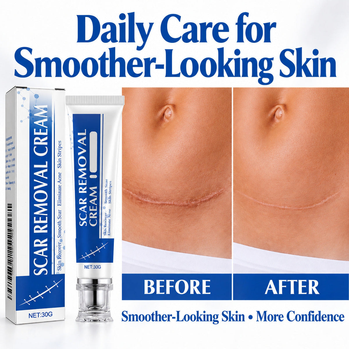 TopSpire®Scar Removal Cream Silicone Scar Gel Daily Care for Smoother-Looking Skin