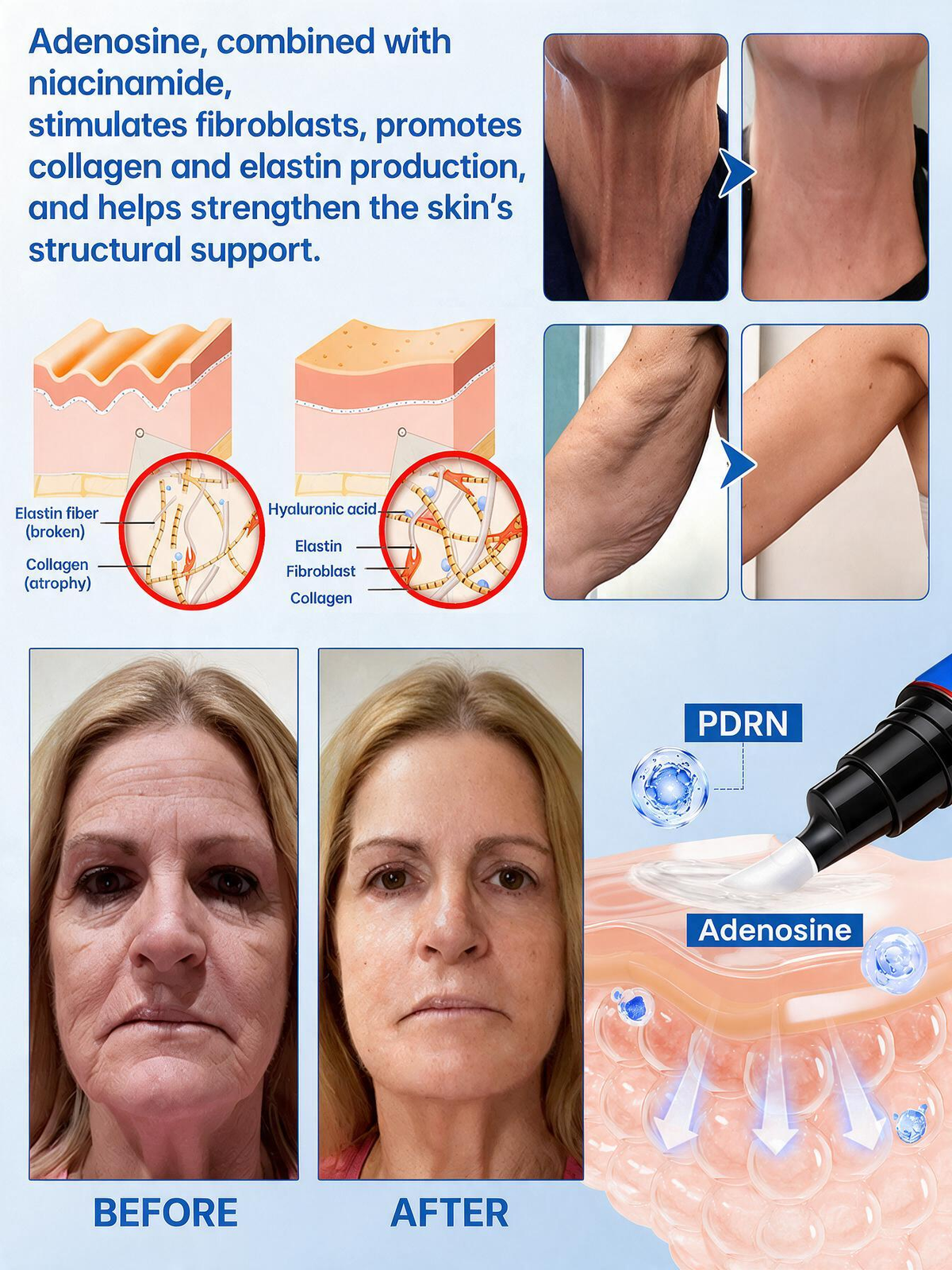 💠🔹🔷🇺🇸 HOT SALE Natravor® PDRN Anti-Wrinkle Shot – Lift & Firming Cream