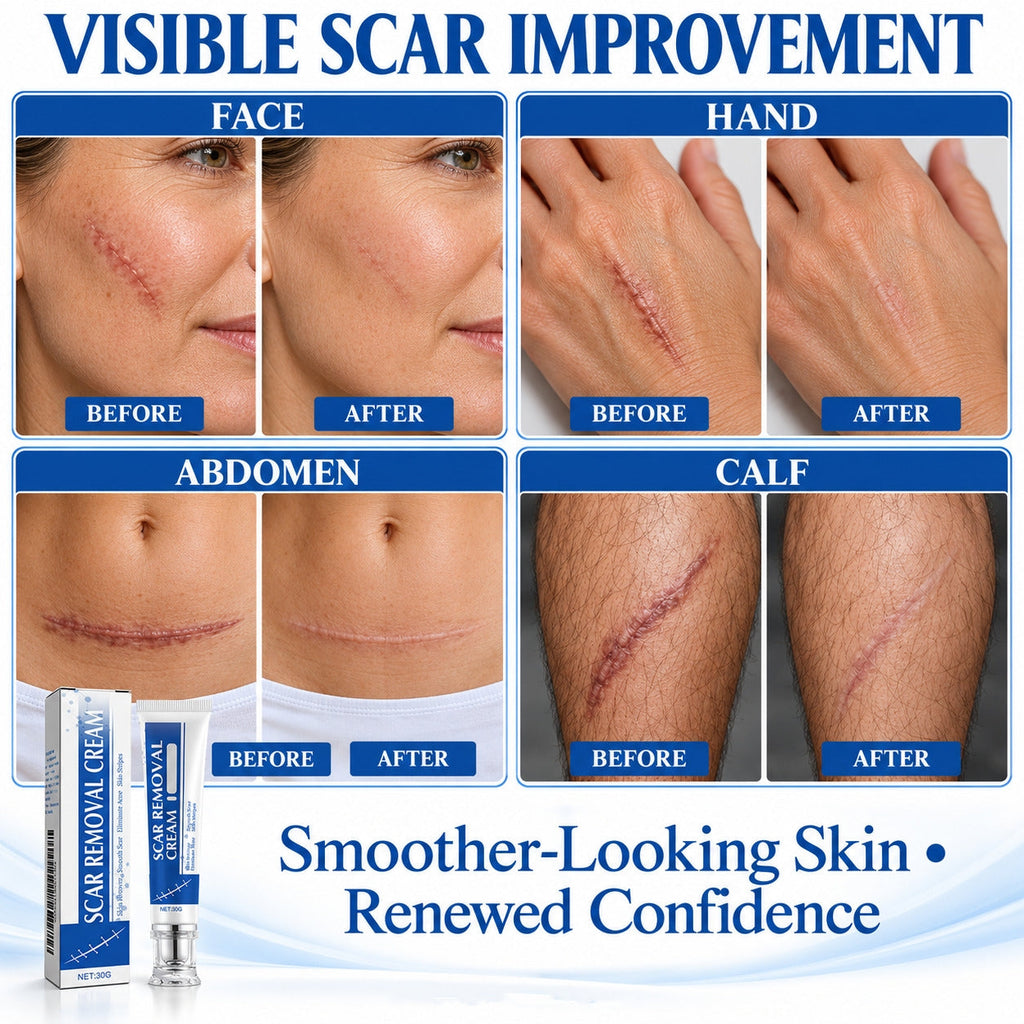 TopSpire®Scar Removal Cream Silicone Scar Gel Daily Care for Smoother-Looking Skin